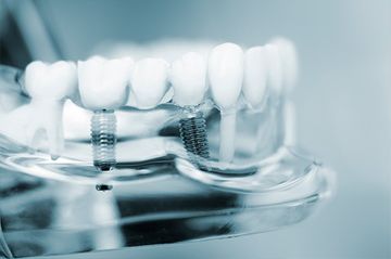 Neodent Clínica Dental dientes 3D