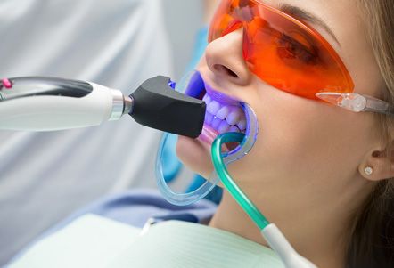 Neodent Clínica Dental blanqueamiento